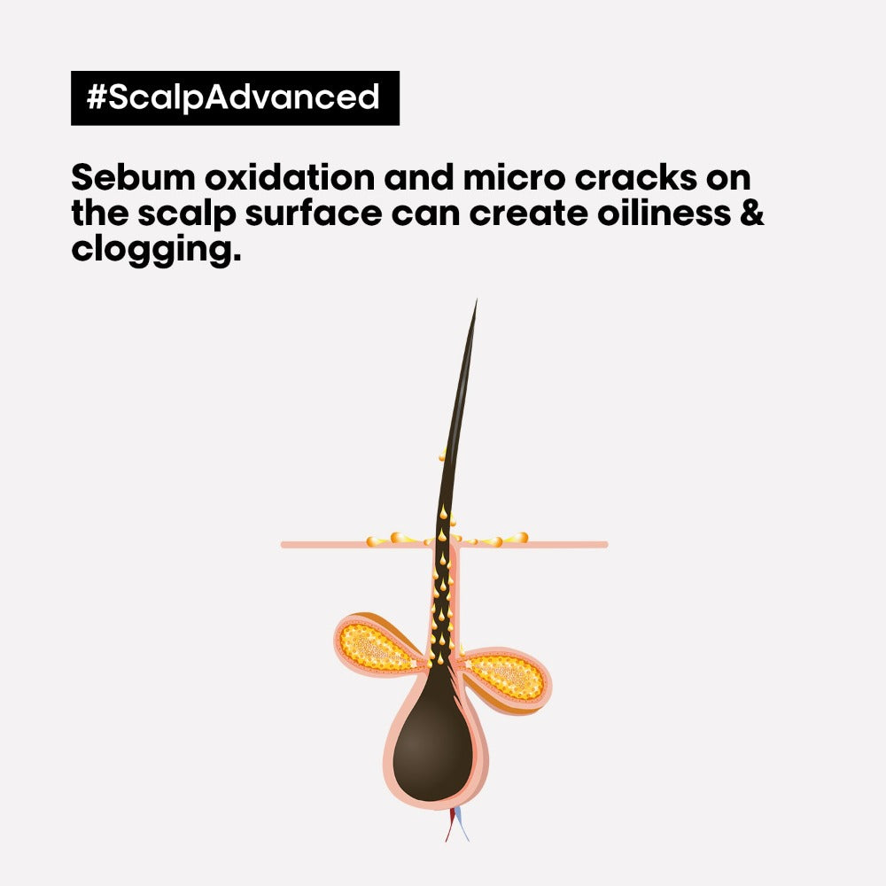 L'Oréal Professionnel Scalp Advanced Anti Oiliness Bundle