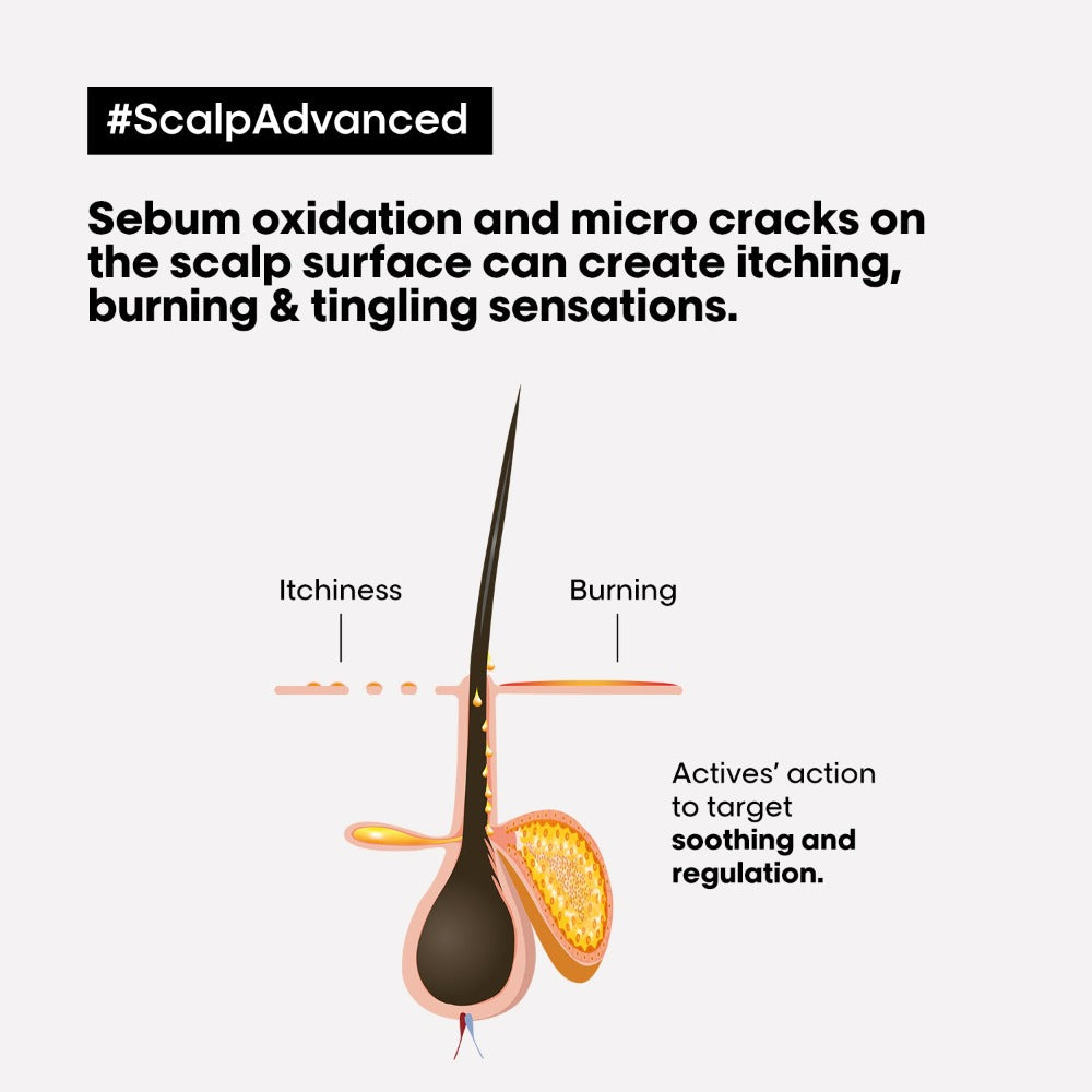 L'Oréal Professionnel Scalp Advanced Anti Discomfort Bundle