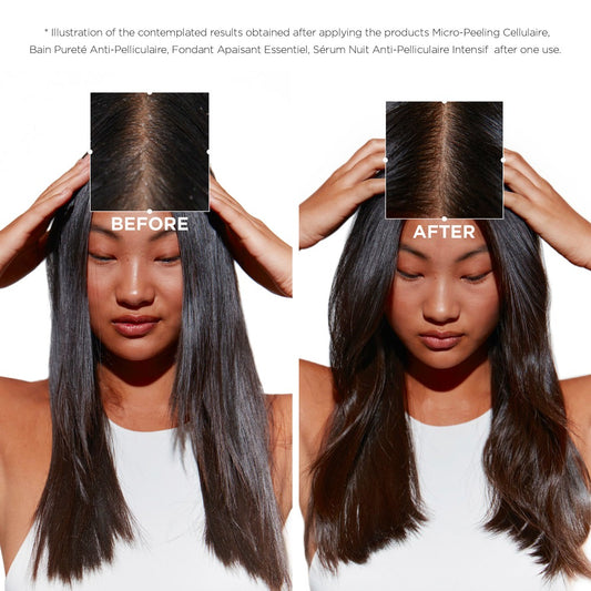 Kérastase Symbiose Creme Bundle Dry Scalp For Medium To Thick Hair