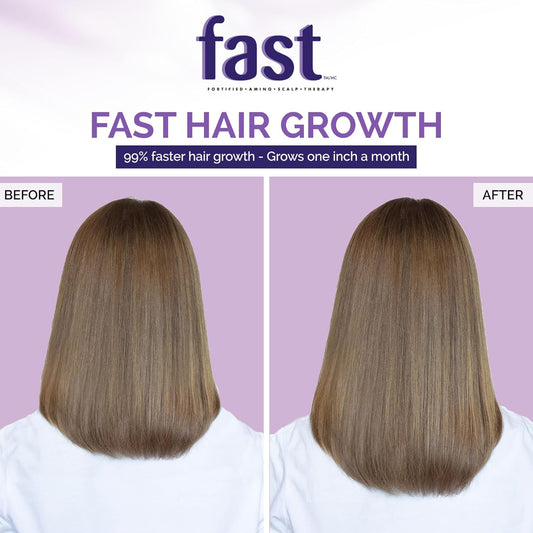 Nisim Scalp Tonic Normal To Oily Hair 120ml